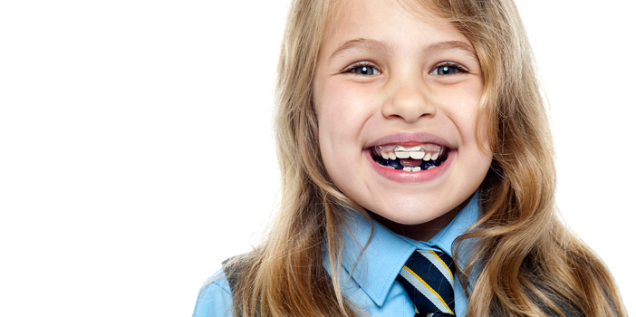 Early Prevention of Braces