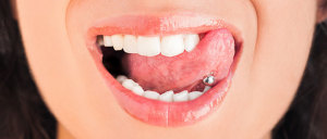 Girl with Tongue Piercing - Biermann Orthodontics
