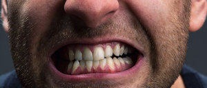 19 Habits That Wreck Your Teeth - Teeth Grinding - Biermann Orthodontics