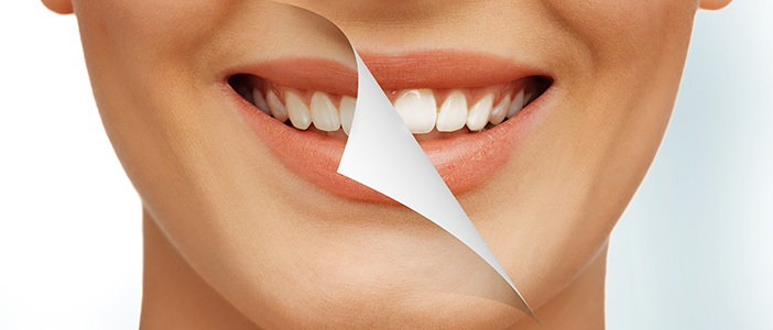 10 Tips for Healthy, White Teeth - Biermann Orthodontics