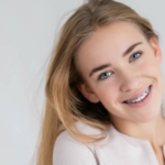 what are orthodontic spacers