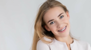 what are orthodontic spacers