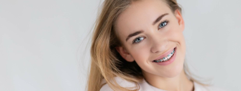 what are orthodontic spacers