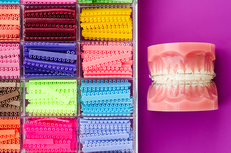 What Are Elastics for Braces?