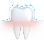 Tooth Enamel