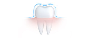 Tooth Enamel