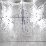 Orthodontic Case Study