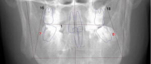 Orthodontic Case Study