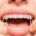 Elastic Timing: When Do Rubber Bands Join the Braces Party?