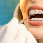 what happens at your first orthodontist appointment