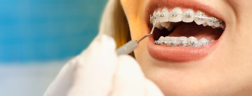 what happens at your first orthodontist appointment