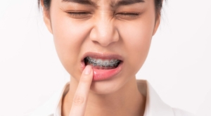 braces pain relief